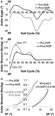 Effects of Selective Dorsal Rhizotomy on Ankle Joint Function in Patients With Cerebral Palsy